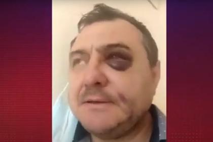 В Сочи избили бывшего солиста группы «Лесоповал»