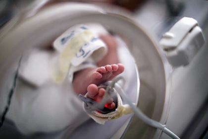 Самый недоношенный в мире ребенок отпраздновал первый день рождения