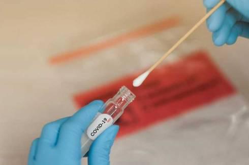 Карагандинцы могут сдать ПЦР-тест в областном центре по профилактике и борьбе со СПИДом