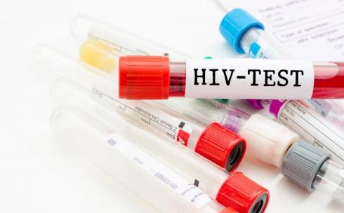 Регулярно проходите обследование на ВИЧ