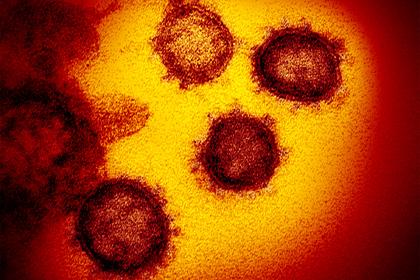Найден способ остановить размножение коронавируса