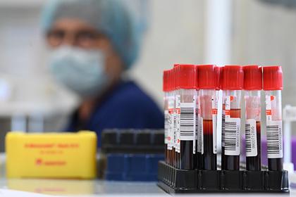 Российский врач объяснил причину ошибок тестов на коронавирус