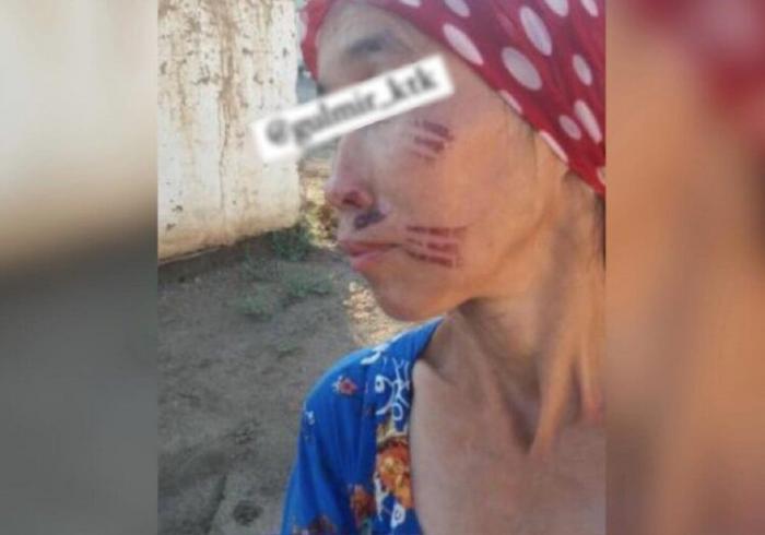 Плохо убралась: невестке выжгли лицо раскаленной вилкой в Туркестанской области