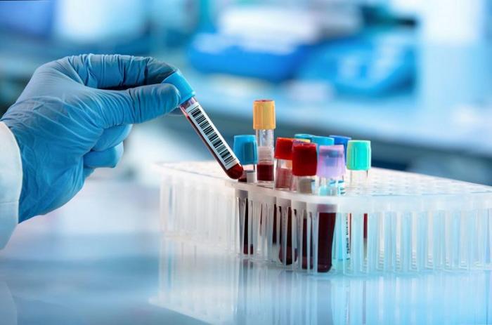 Алматинский ученый считает, что проверять кровь на антитела против коронавируса нет смысла