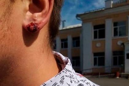 Директор российской школы порвал ухо ученику за отказ снять серьгу