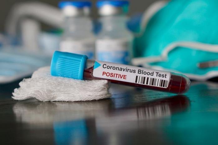 4024 заболевших коронавирусом выявили за сутки в Казахстане
