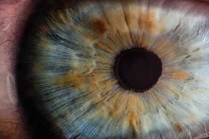 Выяснен механизм развития смертельного вида рака глаза