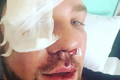 Избитый тремя дагестанцами в метро россиянин показал фото из больницы