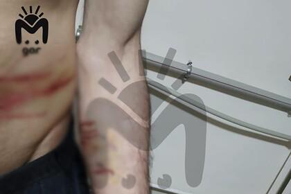 Опубликованы фото со следами избиений на устроивших бунт российских заключенных