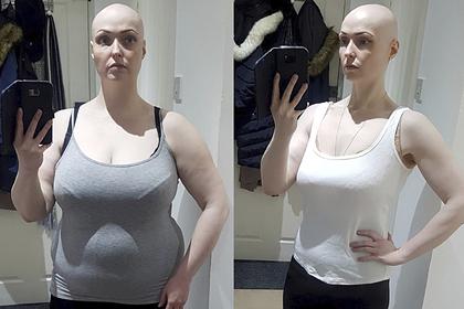 Женщина отказалась от одной привычки и похудела на 36 килограммов за год