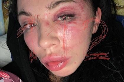Появились подробности жестокого избиения девушки российским бойцом MMA