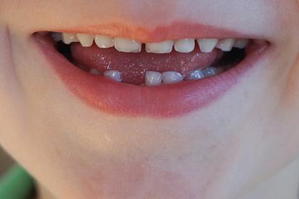 Доктор Комаровский развеял миф о молочных зубах