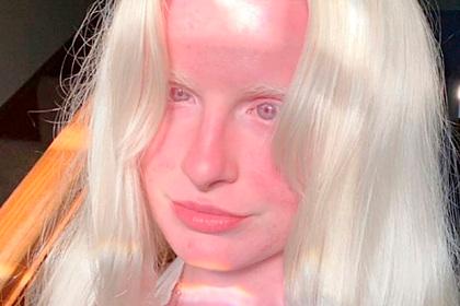 Девушку прозвали неземным существом в сети из-за необычного цвета глаз