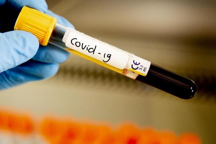 За сутки в Казахстане выявлены 1083 заболевших коронавирусом