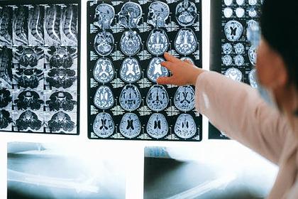 Медики назвали способ улучшить работу мозга за десять минут