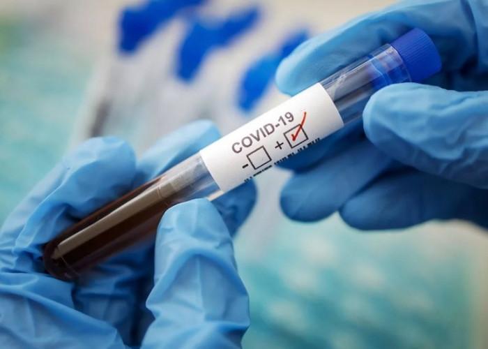 467 человек заболели коронавирусом в Алматинской области