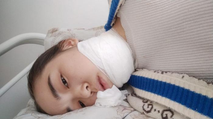 После неудачного лечения зуба девочка из Кызылорды перенесла три операции
                27 января 2022, 18:43