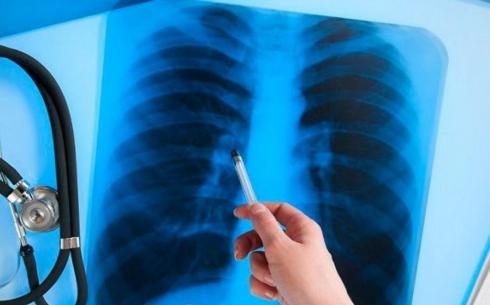 Месячник по профилактике туберкулеза проводится в Карагандинской области