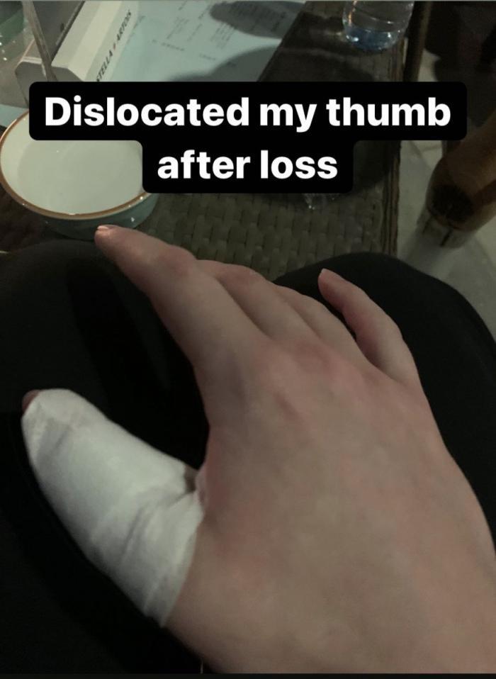 «Skiter» вывихнул палец после поражения на турнире в Дубае