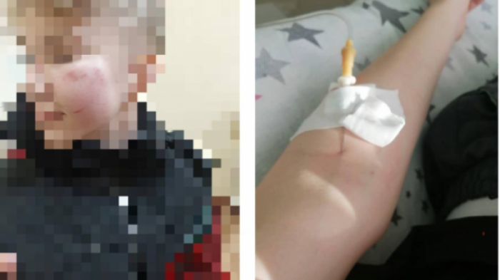 Семиклассника избили до потери сознания на территории школы в Экибастузе
                16 марта 2022, 02:09