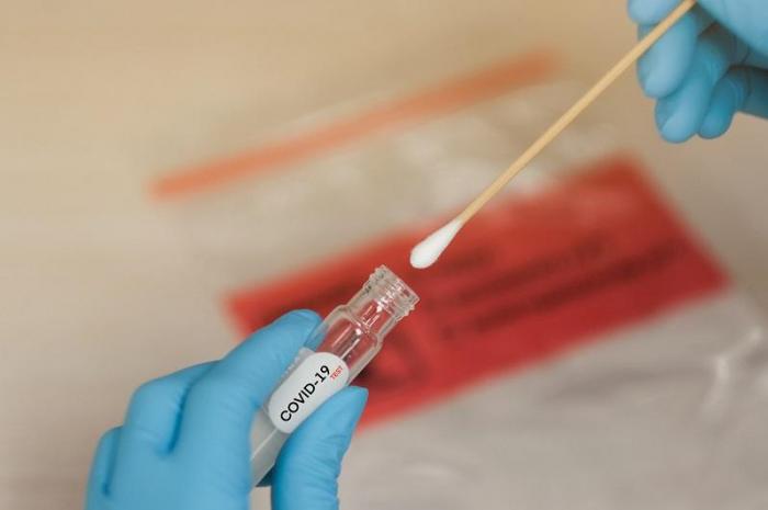 За прошедшие сутки зарегистрировано 36 новых случаев заболевания коронавирусной инфекцией