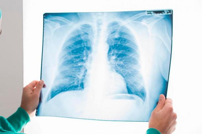 Случаев заболевания пневмонией с признаками КВИ не зафиксировано в РК за сутки