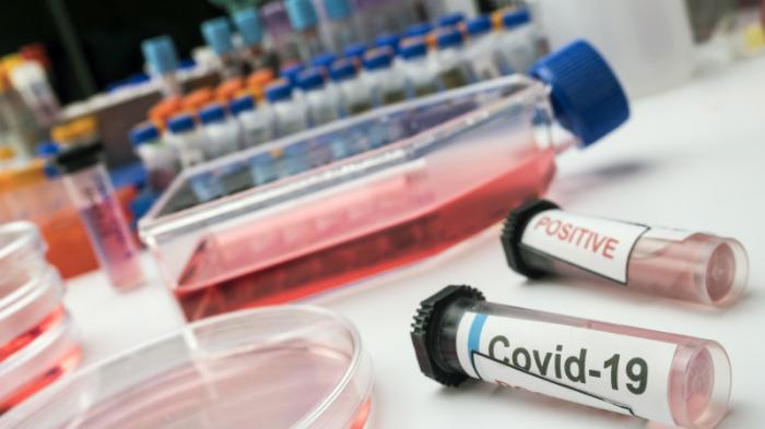 Женщина заразилась COVID-19 дважды за рекордных 20 дней
                21 апреля 2022, 19:16