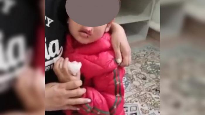 В Атырау 5-летнюю девочку за лицо укусила собака
                10 мая 2022, 17:59
