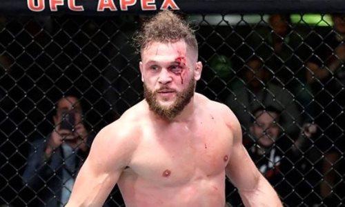 Уроженец Казахстана из UFC показал фото шокирующей травмы
