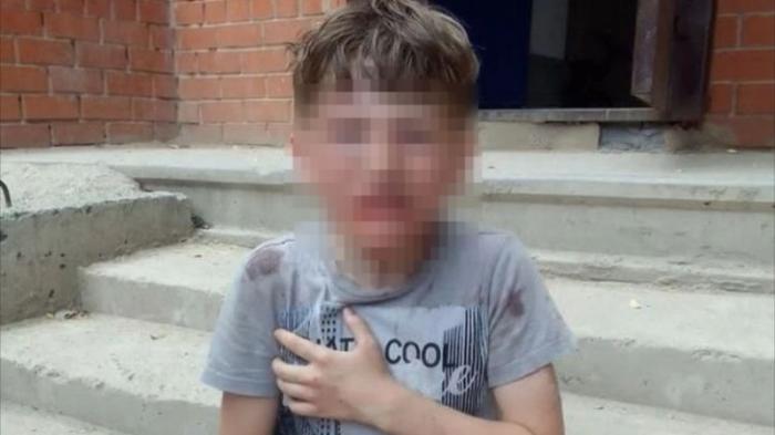Мужчина избил девятилетнего ребенка в Косшы
                31 мая 2022, 17:27