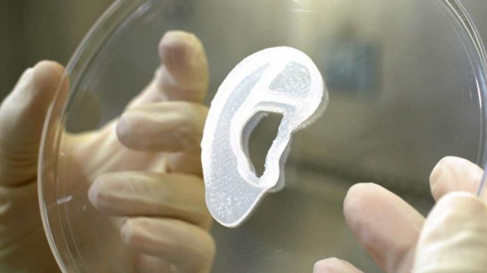 Напечатанное на 3D-принтере ухо пересадили пациентке в США
                03 июня 2022, 14:16
