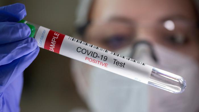 Симптомы COVID-19 сохраняются у каждого пятого переболевшего - исследование
                23 июня 2022, 09:48