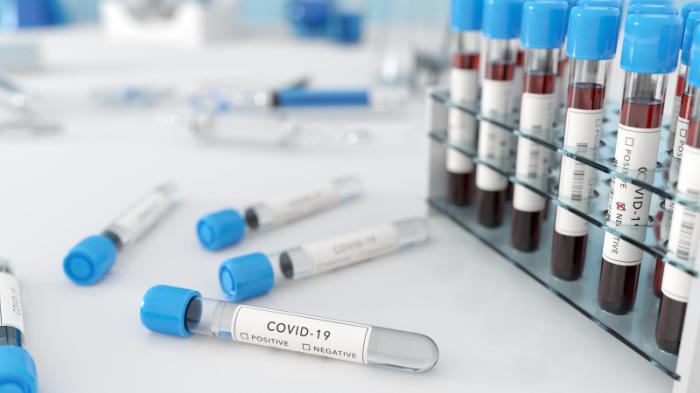Сверхбыстрый тест для выявления штаммов COVID-19 разработали в США
                04 июля 2022, 14:15