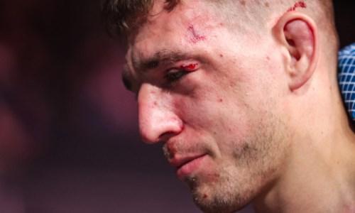Боец UFC после удара коленом получил несколько переломов лицевых костей. Видео