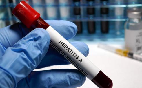 В этом году в Карагандинской области снижается заболеваемость вирусным гепатитом А