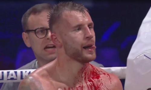 Украинский пожарный разбил голову нокаутированному Головкиным боксеру