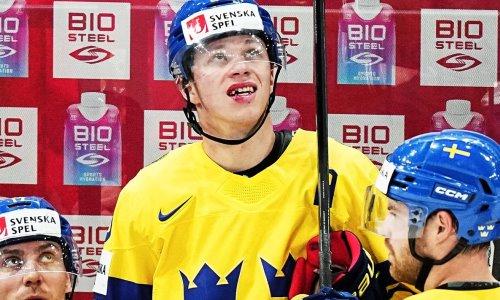 Звезда шведского хоккея поразил реакцией на потерянный зуб из-за удара клюшкой по лицу на ЧМ-2023. Видео