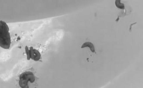 Более десяти живых червей извлекли медики из носа двухлетней девочки в Караганде
