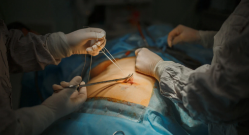 Завещаю свое тело на органы: за 10 лет в Казахстане 16,6% пересадок органов проведено от посмертных доноров