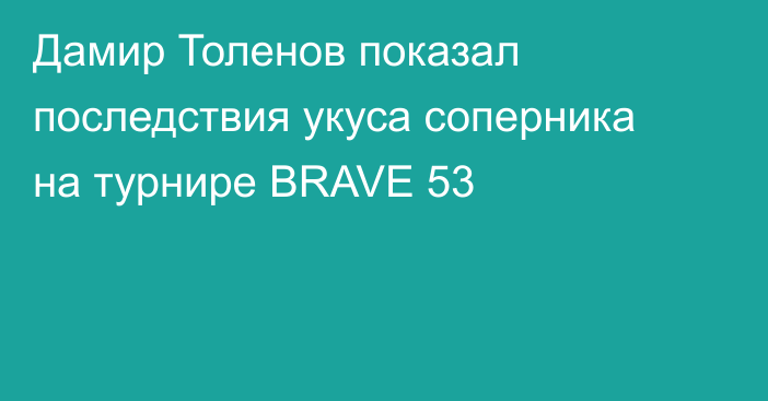 Дамир Толенов показал последствия укуса соперника на турнире BRAVE 53
