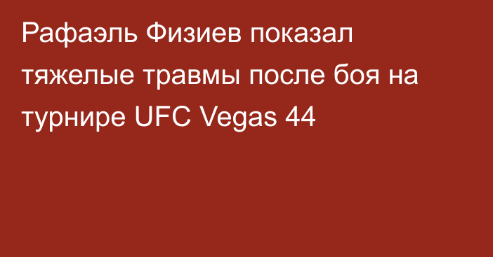 Рафаэль Физиев показал тяжелые травмы после боя на турнире UFC Vegas 44