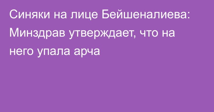 Синяки на лице Бейшеналиева: Минздрав утверждает, что на него упала арча