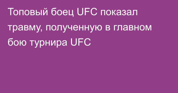 Топовый боец UFC показал травму, полученную в главном бою турнира UFC