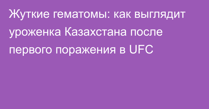 Жуткие гематомы: как выглядит уроженка Казахстана после первого поражения в UFC