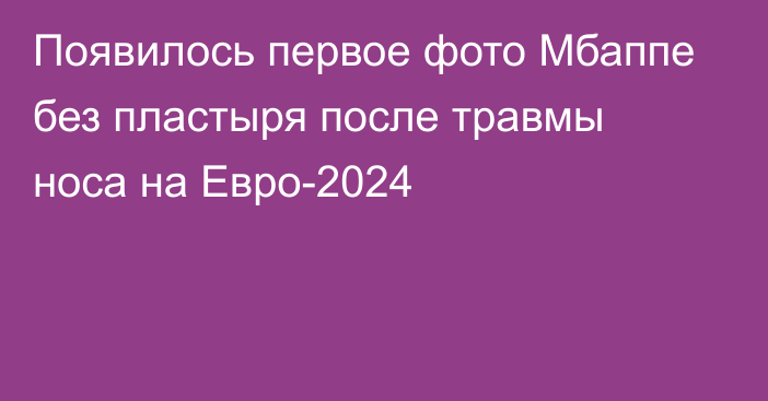 Появилось первое фото Мбаппе без пластыря после травмы носа на Евро-2024