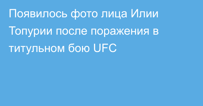 Появилось фото лица Илии Топурии после поражения в титульном бою UFC