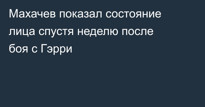 Махачев показал состояние лица спустя неделю после боя с Гэрри